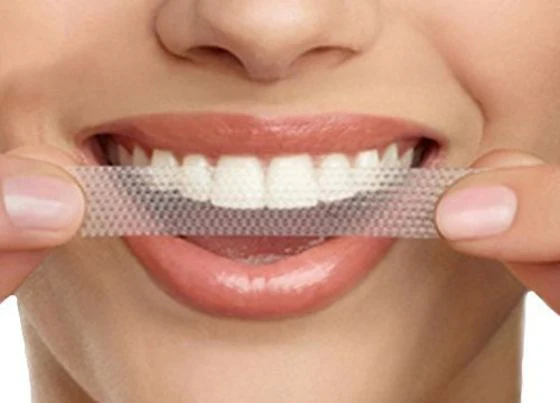 How Often Should You Use Whitening Strips